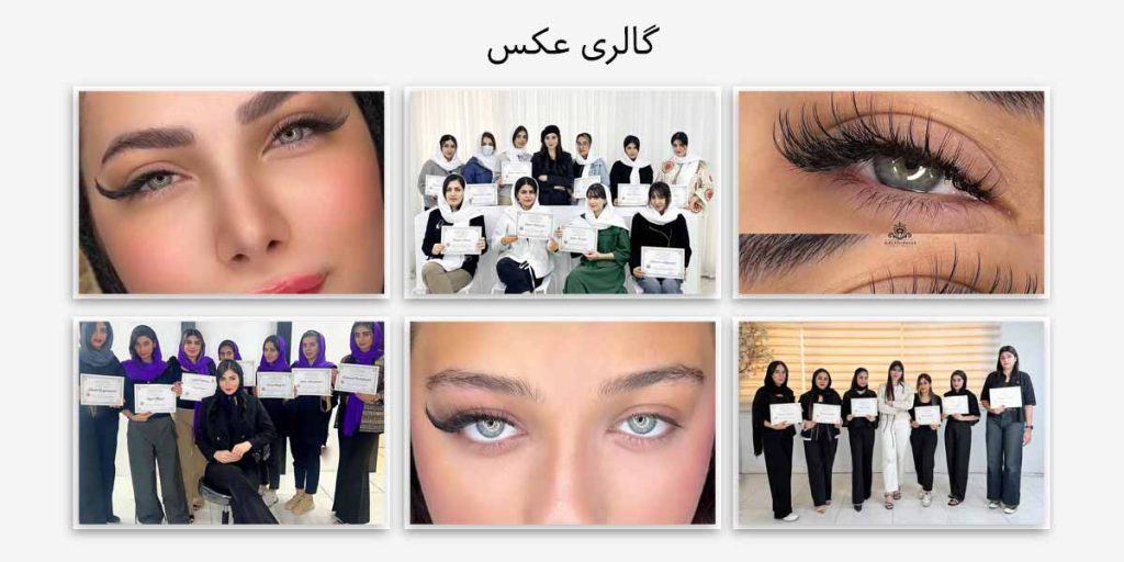 گالری تصاویر آیدا خشنود